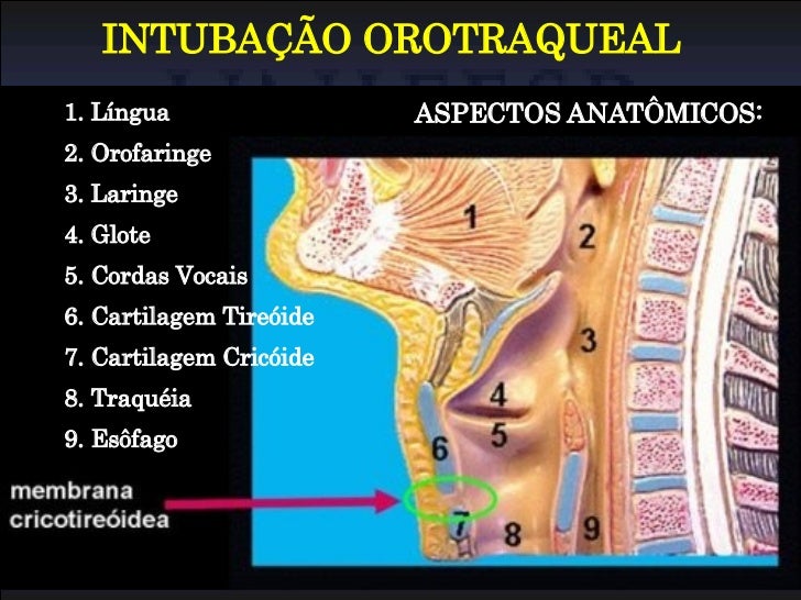 intubacao orotraqueal